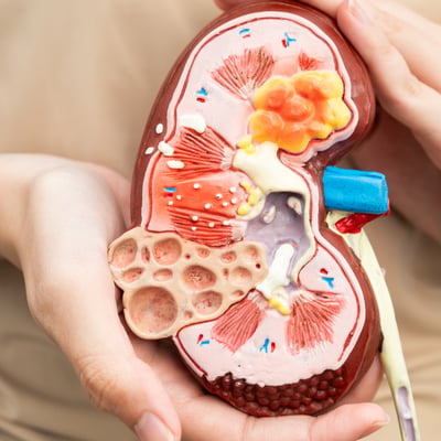 Kidney Disease