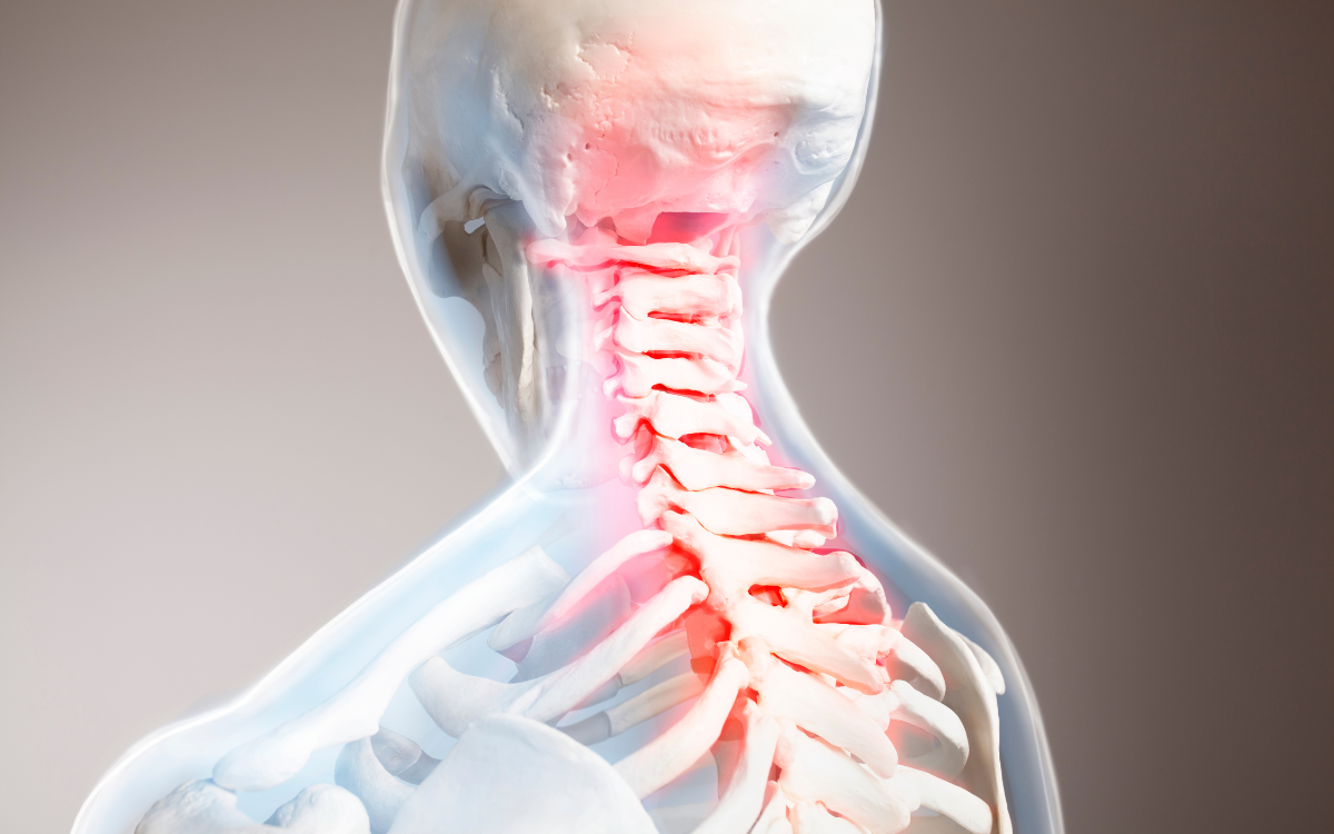 🦴 Cervical Pain Treatment