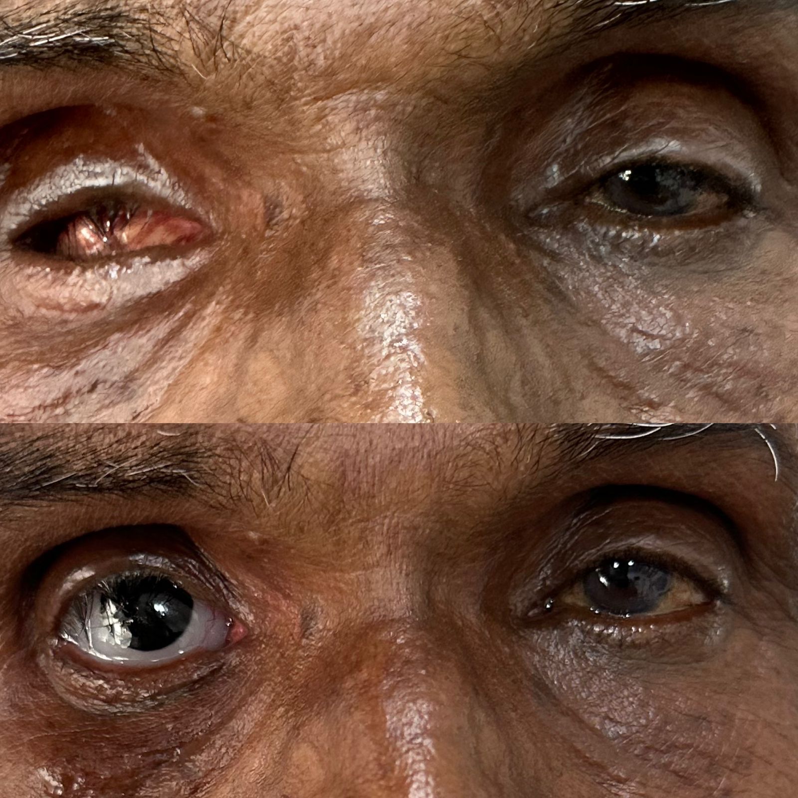 π¨ββοΈ Eye Disease Care