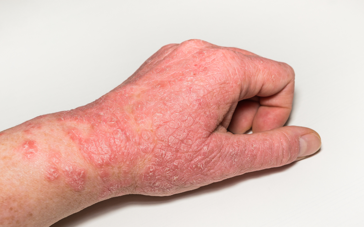 Skin & Allergy Treatment 🌿🩹