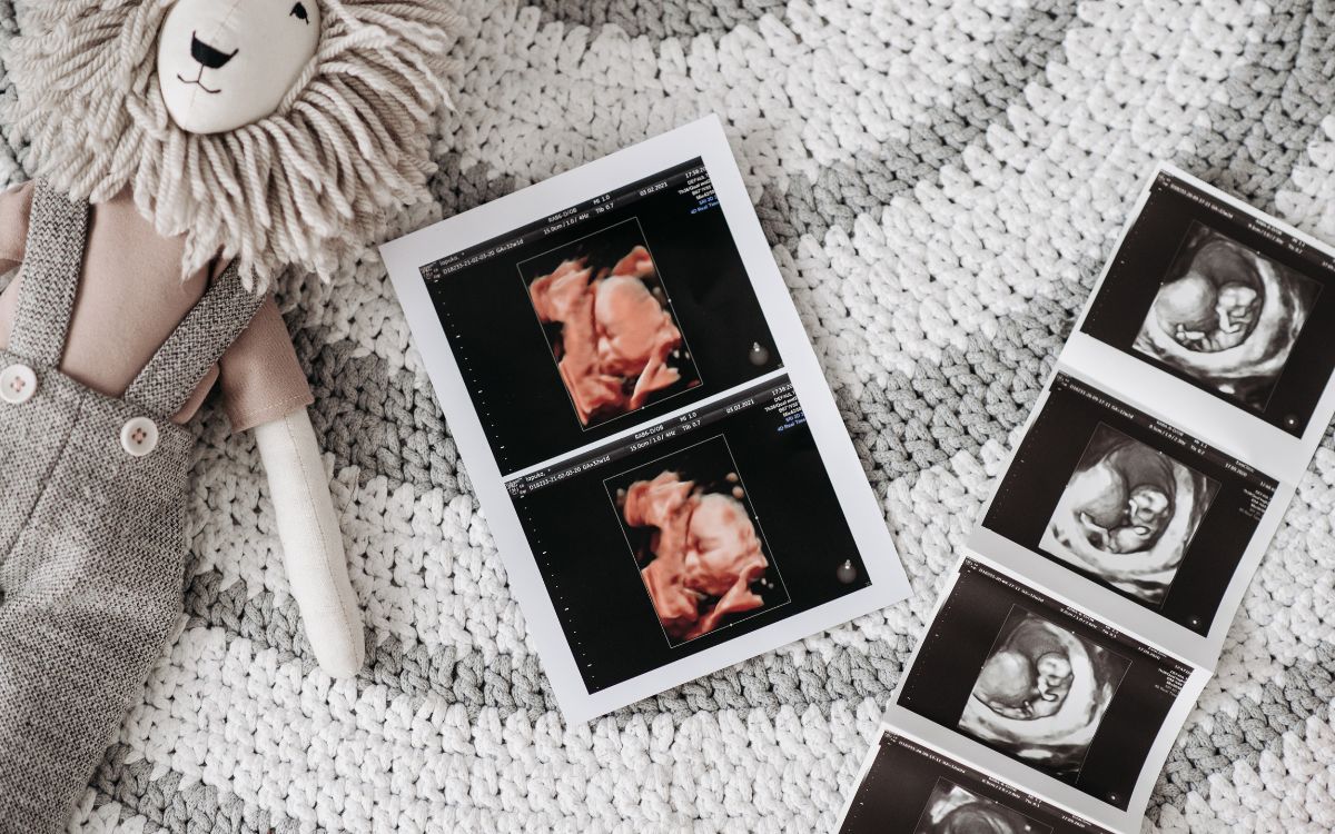 Colour / Black & White Printout 🖨️