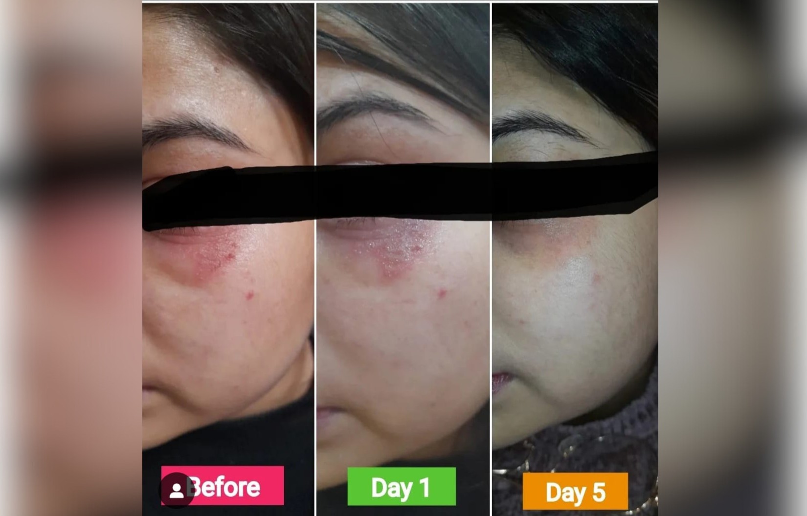 Homeopathic Treatments