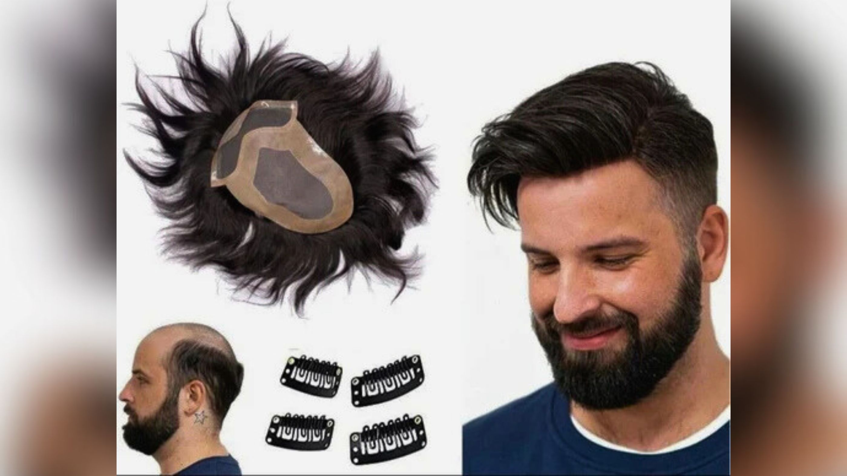 💇‍♂️ Hair Patches